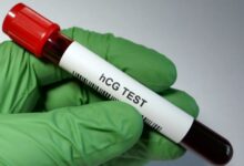 When to Take a Pregnancy Blood Test?